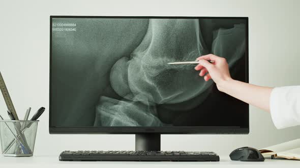 Doctor Veterinarian Examining Horse Leg Skeleton Roentgen on Computer Monitor