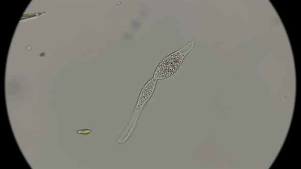 Amphileptus Infusoria Trying To Split Under a Microscope alt