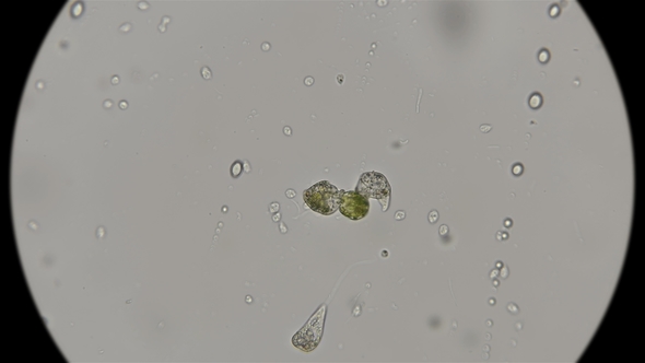 Peranema Microorganism Trying To Eat Algae, Under a Microscope