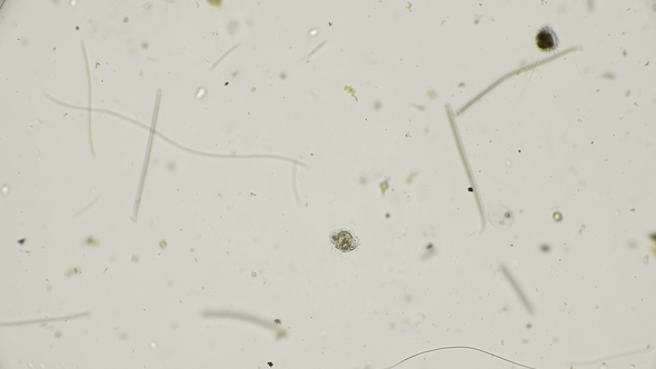 the CAENOMORPHA MEDUSULA Microorganism Under the Microscope