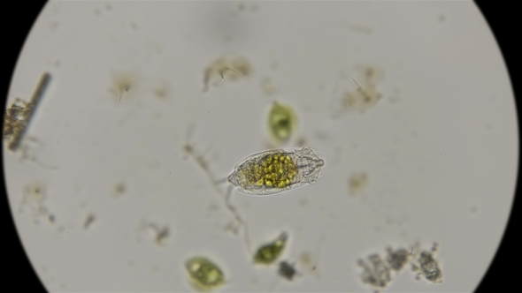 Rotifer Under a Microscope