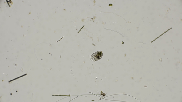 Infusoria Bursaria Truncatella, Under the Microscope