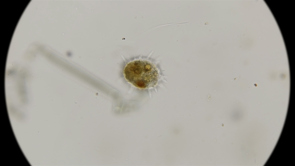 Testate Amoeba Under a Microscope