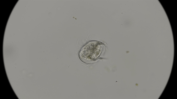 the CAENOMORPHA MEDUSULA Microorganism Under the Microscope
