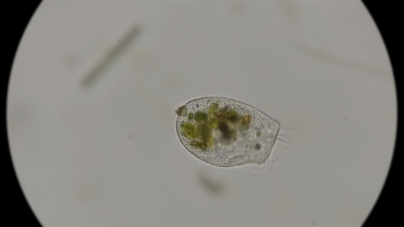 Infusoria Bursaria Truncatella, Under the Microscope alt