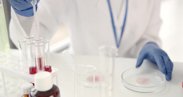 Laboratory Worker Studying Blood Samples to Detect Pathologies