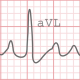 Electrocardiogram Heartbeat - VideoHive Item for Sale