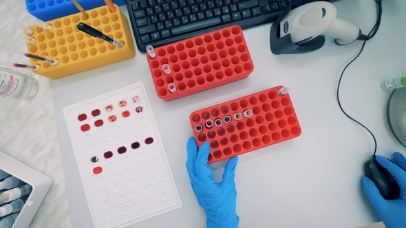 Top View of a Laboratory Expert Sitting in Front of a Computer and Blood Probes alt