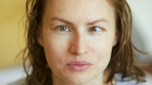 A Large Portrait of a Young Woman with a Vision Problem, Strabismus, Nearsightedness