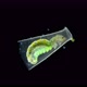 Trichoptera Larva Under a Microscope Family Hydroptilidae - VideoHive Item for Sale