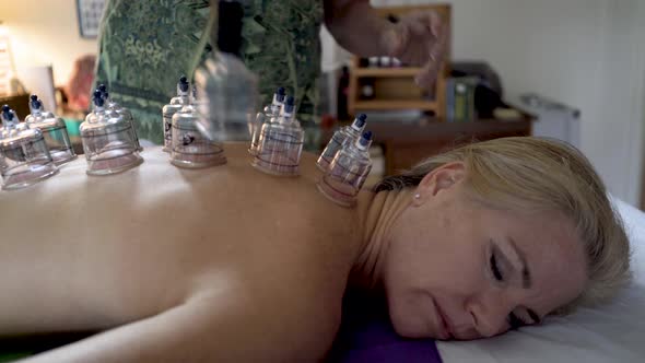 Camera slides to the left and shows a closeup of a pretty, mature woman getting a cupping procedure