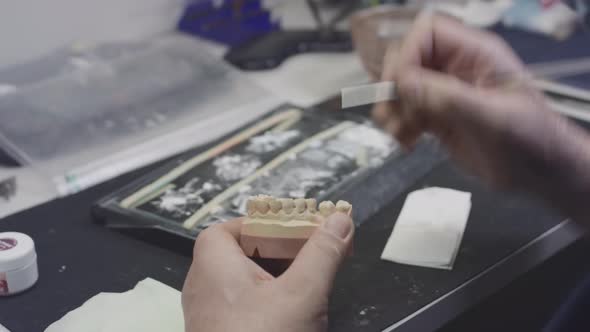 A Dentist Creates a Model of a Jaw Prosthesis and Ceramic Teeth in the Laboratory