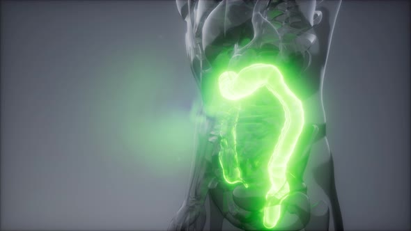 Human Colon Radiology Exam alt