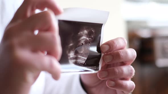 Happy Father Holding Picture of Baby in Mother's Womb Close Up