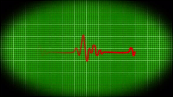 Health ECG Heart Beat Line Simulation animation. Vd 1965 alt