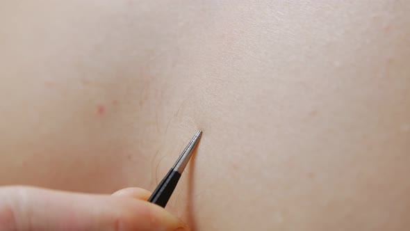 Tweezers Removing Body Hair Closeup