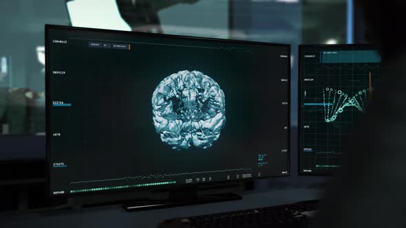 Scanning And Analyzing Brain For Biology Research In Modern Medical Software