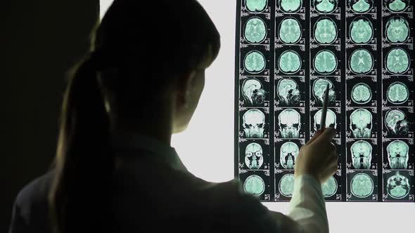 Neurosurgeon Analyzing Brain X-Ray, Blood Vessels Problems, Incurable Illness