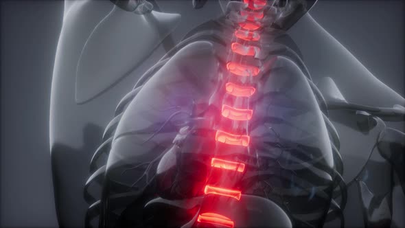 Backache in Back Bones alt