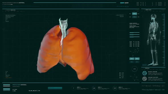 Modern Medical Scan System For Patients Therapy Analyzing Respiratory System alt
