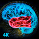 Brain Structure (4-pack) - VideoHive Item for Sale