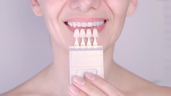Perfect White Teeth Close Up with Shade Guide Bleach Color Female Veneer Smile Dental Care and