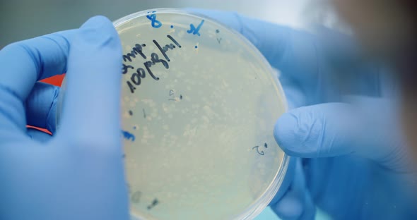 Scientist Looking at Bacteries in Petri Dish at Laboratory