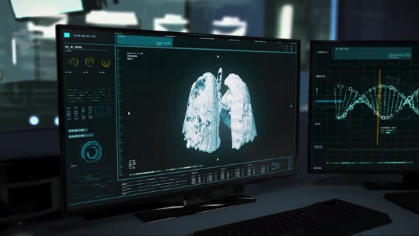 Bio Research Of Lungs Affected By Covid-19 To Set Diagnosis At Laboratory alt