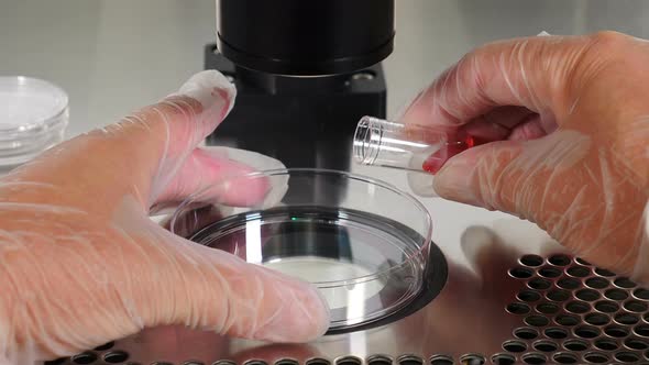 Close-up Shot of IVF Procedure. Embryologist in Protective Gloves Dropping Media From Plastic Test