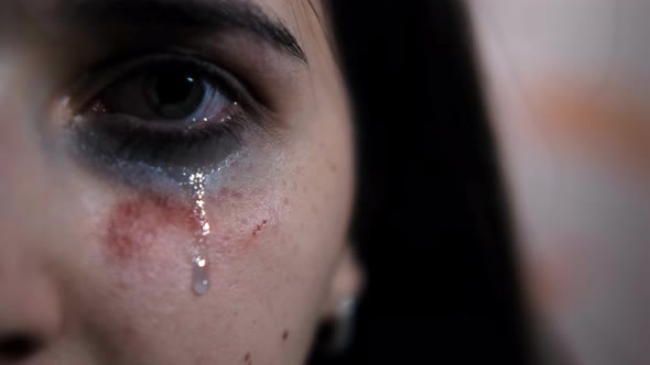 Close-up of the eye of a young female victim of domestic violence. 