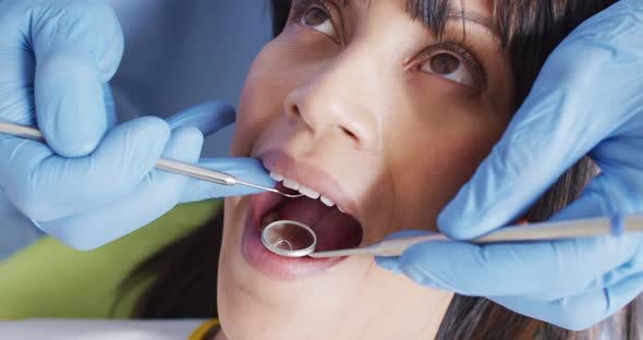 Hands of male dentist examining teeth of female patient at modern dental clinic