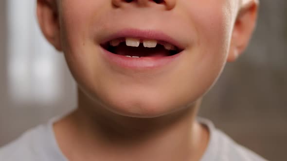 The Boy Smiles and Shows His Fallen Baby Teeth