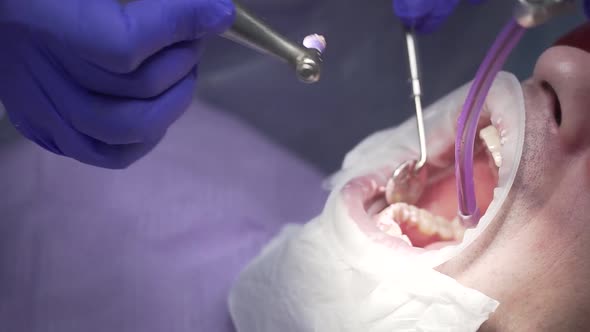 Dentist Conducts Dental Hygiene To the Patient