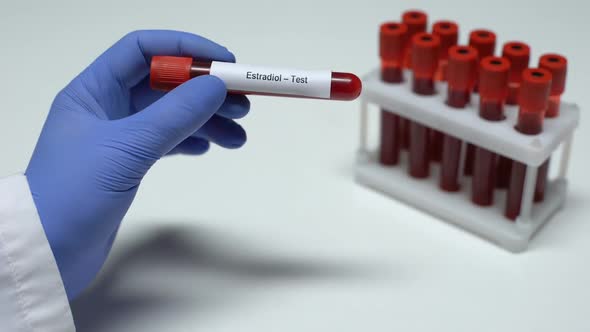 Estradiol, Doctor Showing Blood Sample in Tube, Lab Research, Health Checkup