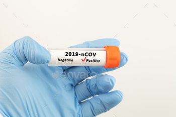 and holds a test tube containing a patient’s sample that has tested positive for coronavirus (COVID-19)