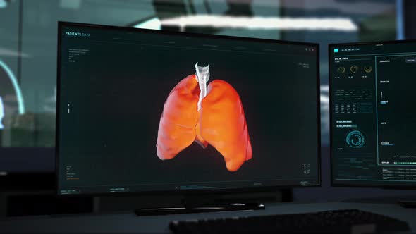3D Visualisation Of Lungs In Modern Diagnostics Software On The Computer Screen alt