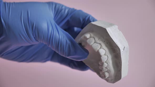 Plaster Model Impression Upper Dental Jaw