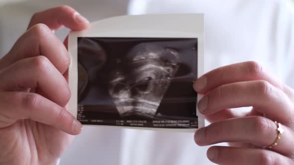 A Female or Male Hand Holds an Ultrasound Image of His Baby