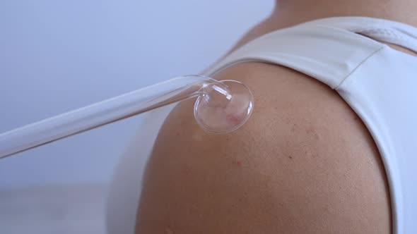 The Doctor Uses the Darsonval Apparatus Against Acne on the Shoulder of a Female Patient