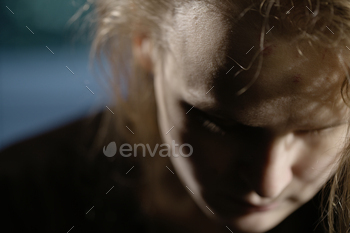 s bruises on her forehead