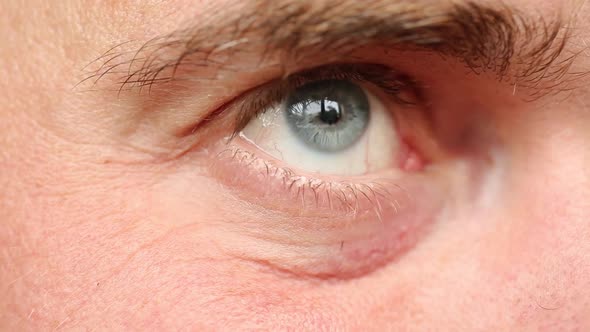 Mans Eyes Close Up. Grey Blue Eyes. Tired Eyes With Veins. Bushy Eyebrows