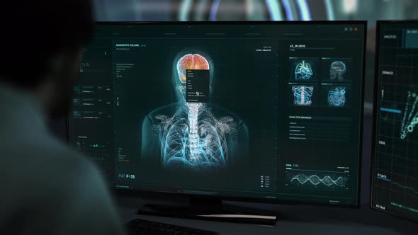 Doctor Uses X-Ray Software Interface To Analyze Patients Brain Health Condition alt