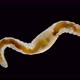 Oligochaeta worm under the microscope, class Clitellata, Phylum Annelida - VideoHive Item for Sale