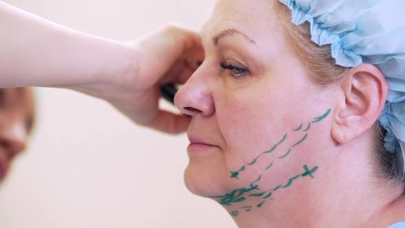 Closeup Side View of Adult Woman 50S60s in Medical Hat Standing Still While Nurse Putting Markings