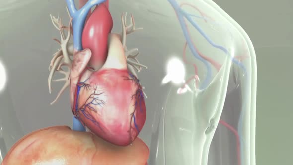 obstruction of the heart vessels