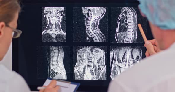 Two doctors are examining an X-ray of a patient's spine on a computer screen.