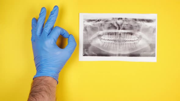 Hand of an orthodontist doctor in a protective rubber blue glove shows the ok sign next to the x ray