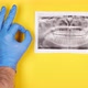 Hand of an orthodontist doctor in a protective rubber blue glove shows the ok sign next to the x ray - VideoHive Item for Sale