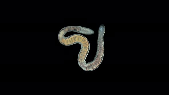 Aulophorus sp worm under a microscope, family Naididae