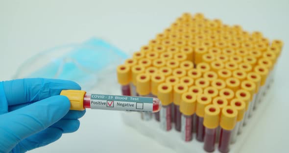 Researcher Hand Showing Tube, Positive Result of Blood Test for Coronavirus, Covid-2.